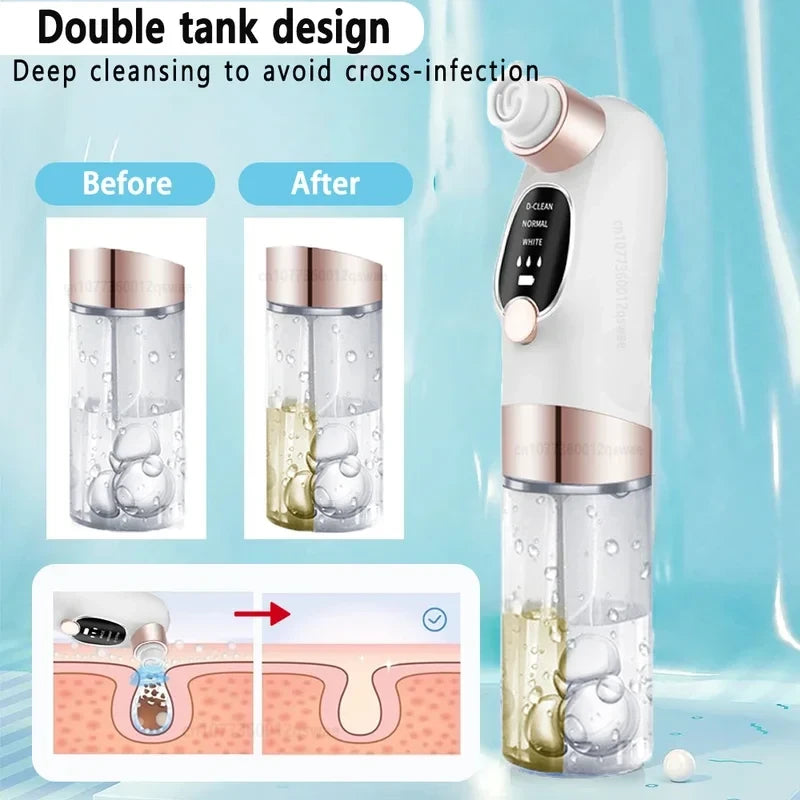 Electric Pore Vacuum Blackhead Remover