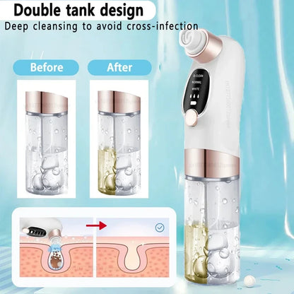 Electric Pore Vacuum Blackhead Remover
