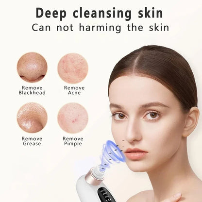 Electric Pore Vacuum Blackhead Remover