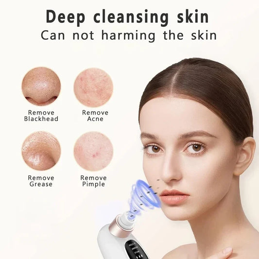 Electric Pore Vacuum Blackhead Remover