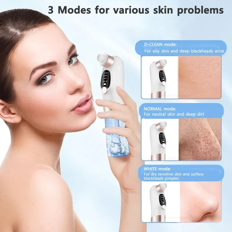 Electric Pore Vacuum Blackhead Remover