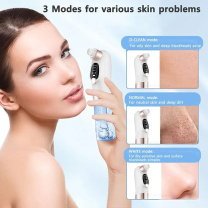 Electric Pore Vacuum Blackhead Remover